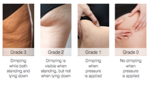 Load image into Gallery viewer, No.2 Cellulite Proof - BerriesSkinCare
