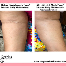 Load image into Gallery viewer, Shop as Bundle &amp; Save- No1 Stretch Mark Proof &amp; No2 Cellulite Proof - BerriesSkinCare