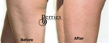 Load image into Gallery viewer, No.2 Cellulite Proof - BerriesSkinCare