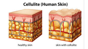 No.2 Cellulite Proof - BerriesSkinCare