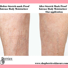 Load image into Gallery viewer, No.1 Stretch Mark Proof - BerriesSkinCare